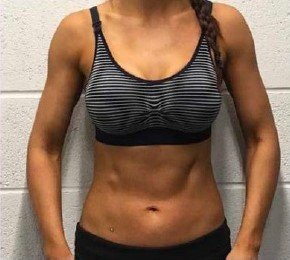 Utána - HIEMT izomépítés