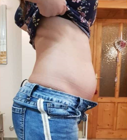 Előtte - Lipomaster 6inl Gép